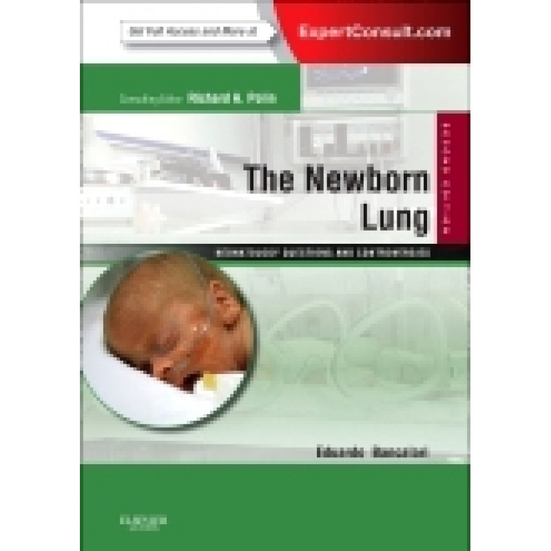 The Newborn Lung: Neonatology Questions and Controversies, 2nd Edition